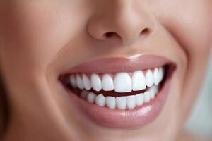 Close-up of a woman smiling with perfect white teeth on a neutral background. photo