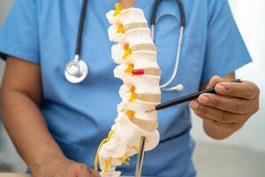 Doctor with lumbar vertebra bone skeleton and nerve model for treatment in the orthopedic department. photo