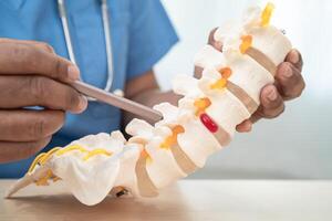 Doctor with lumbar vertebra bone skeleton and nerve model for treatment in the orthopedic department. photo