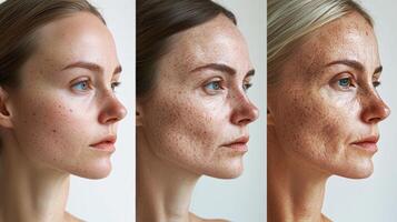 Commercial-style triptych image showing the aging process of a European woman's face, from smooth youthful skin on the left, developing wrinkles in the middle, to deep lines and aged skin on photo