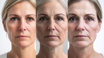 Commercial-style triptych image showing the aging process of a European woman's face, from smooth youthful skin on the left, developing wrinkles in the middle, to deep lines and aged skin on photo