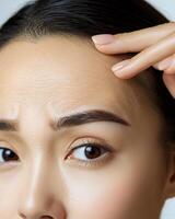 Close-up of an Asian woman's forehead with deep wrinkles, as she uses her fingers to pull and stretch the skin, highlighting the effects of aging and skin elasticity loss, her dark brown hair photo