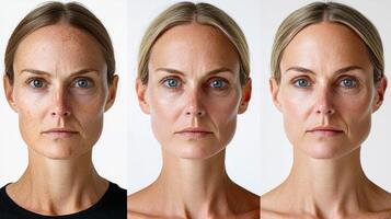 Triptych image illustrating the progression of a woman's face aging, starting with youthful skin on the left, developing fine lines in the middle, and transitioning to deep wrinkles on the right, photo