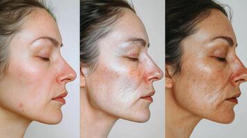 Three-part image showing the gradual aging process of a woman's face, from youthful and smooth skin on the left, through moderate wrinkles in the middle, to deep lines and aged skin on the right, photo