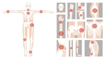 Human figure highlighting common pain points linked to rheumatic disorders, including joints and skeletal regions in a clear, educational format vector