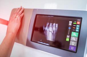 operating x-ray lab. Hand laying at the special equipment photo