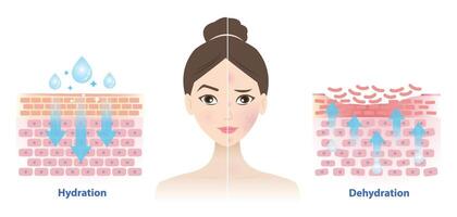 Comparison of hydration and dehydration skin on woman face illustration on white background. The mechanism of skin absorb water, moisture and dry skin lacks water in the uppermost layer. vector