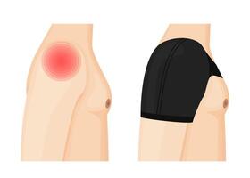 A man experiencing shoulder pain before and after wearing a medical brace. The image illustrates the transition from discomfort to support and recovery. Medical and health related illustration. vector