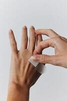 Bandaged hands of two people, one with visible scars. photo