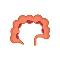 Large intestine showing diverticulitis with appendix illustration vector