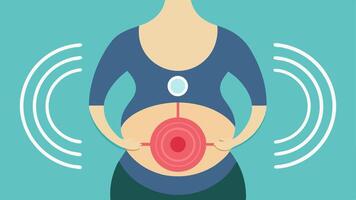 Ultrasound Scan An illustration of an ultrasound transducer p on a pregnant persons abdomen with sound waves visualized as concentric circles.. vector