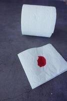 A blood spot is noticeable on a tissue next to a roll of toilet paper in the background photo