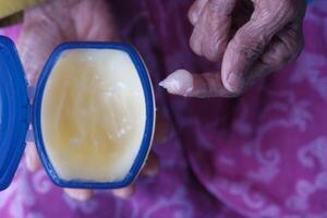 A CloseUp Image of a Hand Grasping a Moisturizing Ointment Contained within a Blue Container photo