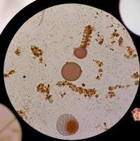Close-up view of various microorganisms under a microscope, showcasing bacteria and other tiny particles. photo