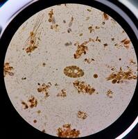 Close-up view of various microorganisms under a microscope, showcasing bacteria and other tiny particles. photo