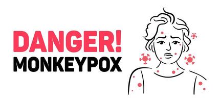 Increasing Awareness of Monkeypox Essential Health Precautions and Recognizing Symptoms. An educational graphic highlighting monkeypox symptoms and dangers to raise public awareness effectively vector