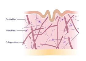 Cross section of skin layer with damaged collagen, elastin fibers and fibroblasts in the dermis illustration on white background. Aging, wrinkled skin, lose strength, flexibility, firmness. vector