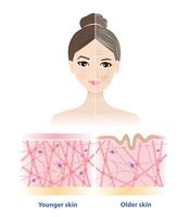Aging process comparison. The difference between younger and older skin on woman face illustration. Cross section of high and low density of collagen, elastin fibers and fibroblasts in dermis. vector