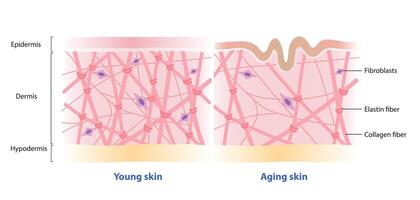 Comparison of young and aging skin on white background. Cross section of high and low density of collagen, elastin fibers and fibroblasts in the dermis layer. Skin care and beauty concept. vector