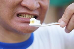 Close up man holds toothbrush with toothpaste. Concept, dental health care. Brush teeth with fluoride toothpaste for hygiene, clean and strong teeth. Prevention from tooth decay. photo