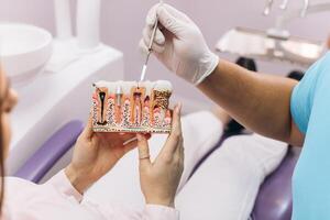 The dentist smiles and shows the girl a model with teeth, talks about implantation and caries. photo