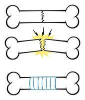 Bone Fracture Line Cartoon Drawing Design. Collection Set - 1 vector