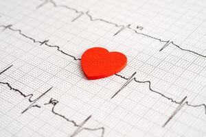Stethoscope on electrocardiogram ECG with red heart and drug, heart wave, heart attack, cardiogram report. photo