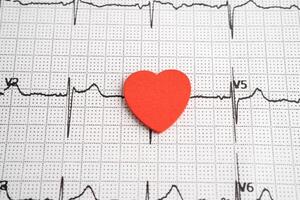 Stethoscope on electrocardiogram ECG with red heart and drug, heart wave, heart attack, cardiogram report. photo