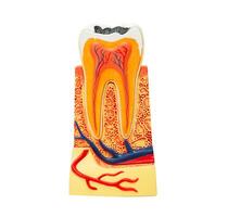 Artificial tooth roots dental implant into jaw isolated on white background with clipping path, Root canal model for dentist. photo