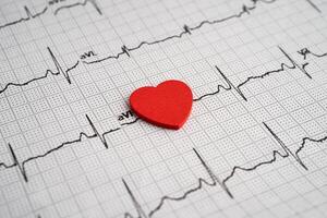 Stethoscope on electrocardiogram ECG with red heart and drug, heart wave, heart attack, cardiogram report. photo