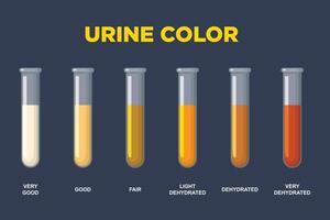 Urine color chart. Hydration and dehydration level diagram. vector