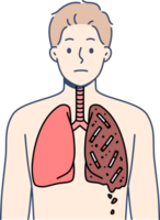 Man smoker with destroyed lungs is forced to suffer due to addiction of tobacco and nicotine. Guy who smokes needs surgery due to smoking for long time and lack of willpower for fight bad habit. png