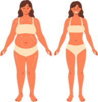 lipoaspiração para excesso de peso mulher posando dentro roupa íntima antes e depois de cirurgia. lindo menina dentro precisar do lipoaspiração demonstra progresso alcançado sem usar do dietas e ginástica png