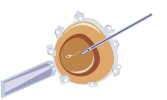 Artificial insemination of oocyte, intracytoplasmic injection, IVF vector