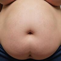 Obese person with large midsection photo