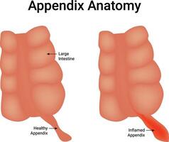 Appendix Anatomy Science Design Illustration Diagram vector
