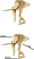 The two different types of the hip joint vector