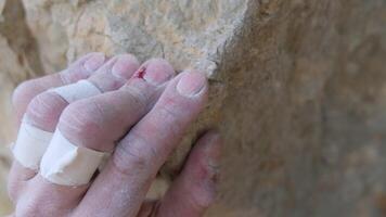 Scaling New Heights. The Resilient Journey of a Climber with Bandaged Hands video