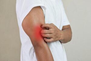 Man scratches his hands, skin allergy, itchy dry skin eczema dermatitis photo