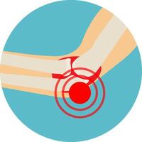 arthritis or arthrosis of the elbow joint. anatomy of the elbow joint. illustration in flat style vector