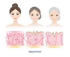 Aging process comparison with 3 generation women face illustration. Cross section of high density, depletion and low density of collagen, elastin fibers and fibroblasts in the dermis. vector
