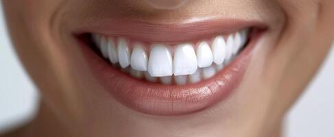 Close Up of White Teeth Smiling With Glossy Lips photo