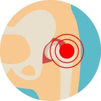 Hip joint structure. Arthritis of the hip joint. Hip Osteoarthritis Icon. Pain, fracture or inflammation in pelvis. Front view vector