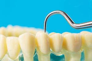 Checking tartar with a dental instrument on a mock-up of a dental jaw, macro. Removal and cleaning of tartar and oral cavity in dentistry. Copy space for text photo