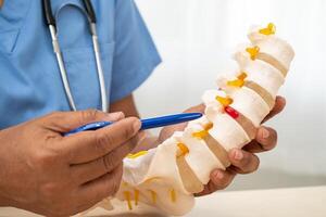 Doctor with lumbar vertebra bone skeleton and nerve model for treatment in the orthopedic department. photo
