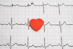 Red heart on electrocardiogram ECG with red heart, heart wave, heart attack, cardiogram report. photo