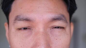 A close-up shot of an Asian man's eyes, appearing tired and slightly droopy. The image captures fine details, such as skin texture and faint wrinkles video