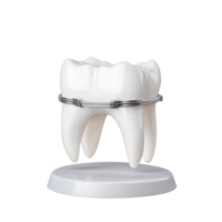 Model of two teeth with braces on a stand on transparent background png