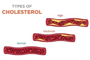 LDL, HDL, and Triglycerides and Their Effects on Health vector