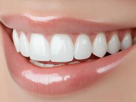 Bright, healthy smile showcased with perfect teeth in close-up view photo